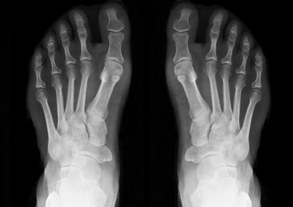 Hol található a testünkben a sajkacsont?