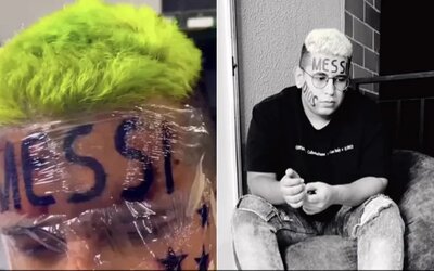 Egy kolumbiai influenszer a homlokára tetováltatta Messi nevét, de már bánja