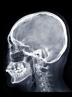 REFRESHER-KVÍZ: Mennyit tudsz az emberi testről?
